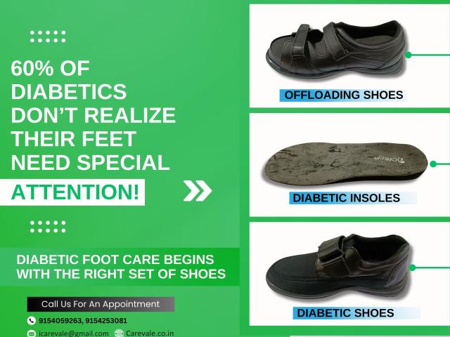 Free Artificial leg In Hyderabad | CareVale Prosthetics