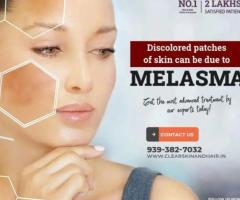 Laser treatment clinic in india