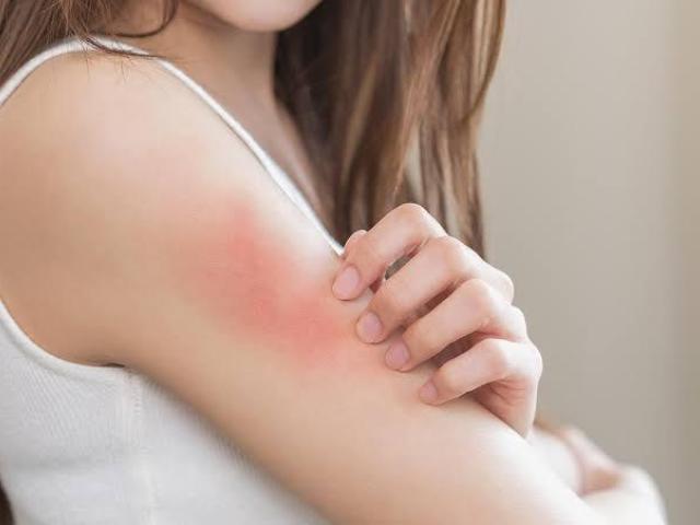 Itching Treatment in Ghatkopar