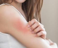 Itching Treatment in Ghatkopar
