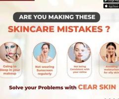 Advance Tattoo Removal Treatment  in india