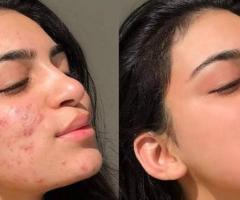 Photo retouching service