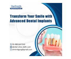 Transform Your Smile with Advanced Dental Implants