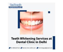 Teeth Whitening Services at Dental Clinic in Delhi